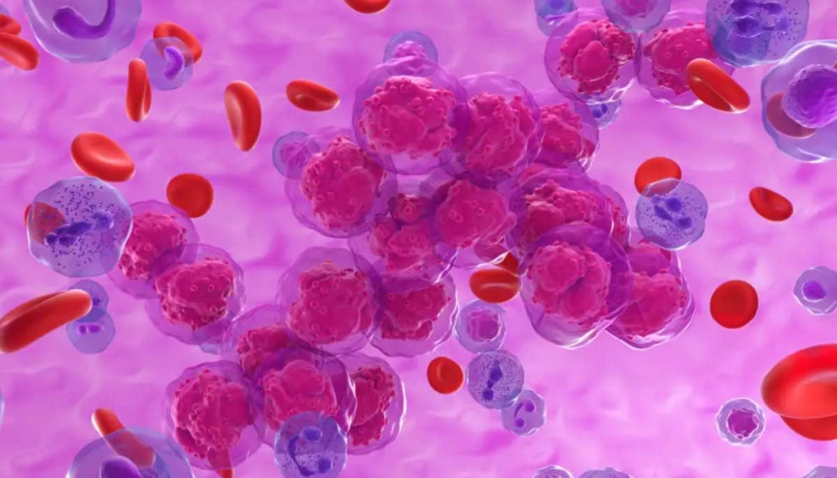 A new &ldquo;living drug&rdquo; offers hope for patients with aggressive blood cancer