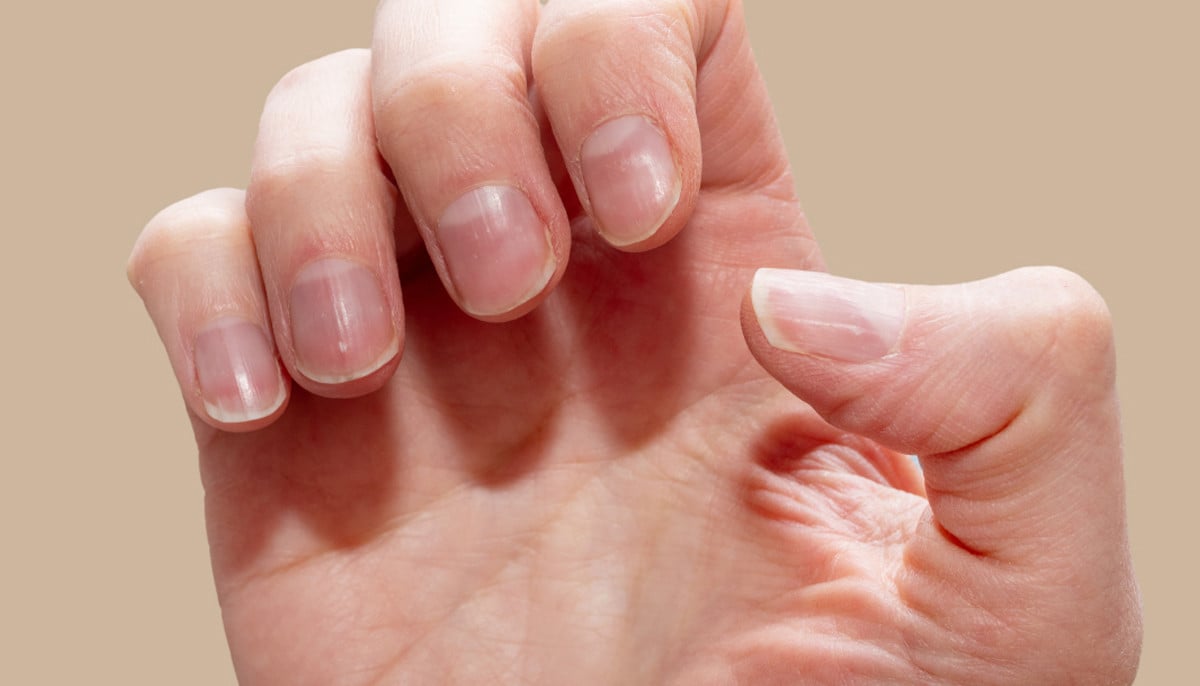 7 nail colour changes doctors say you shouldn’t ignore