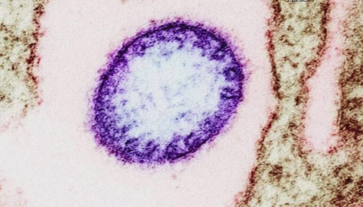 Deadly Nipah virus outbreak explained as WHO confirms infections
