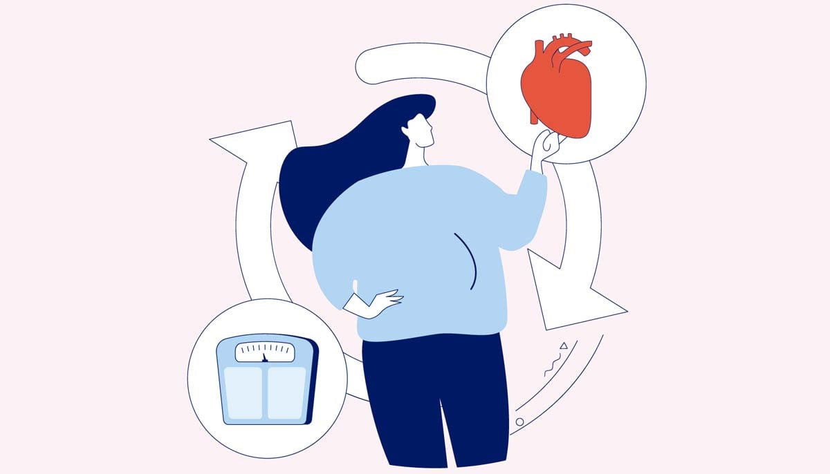 Struggling with obesity? Here's how to manage it