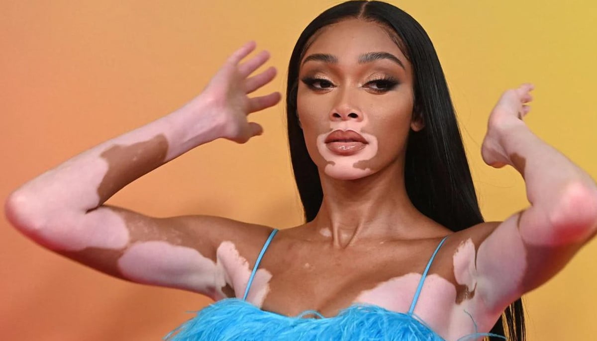 Winnie Harlow breaks vitiligo stereotypes: 'I'm not a sufferer' 