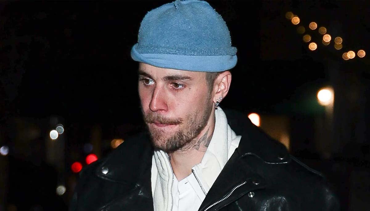 Everything to know about Justin Bieber's facial paralysis