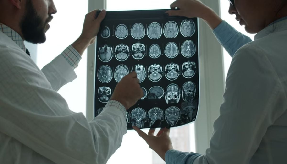 Shopify CEO uses Claude AI to build MRI viewer