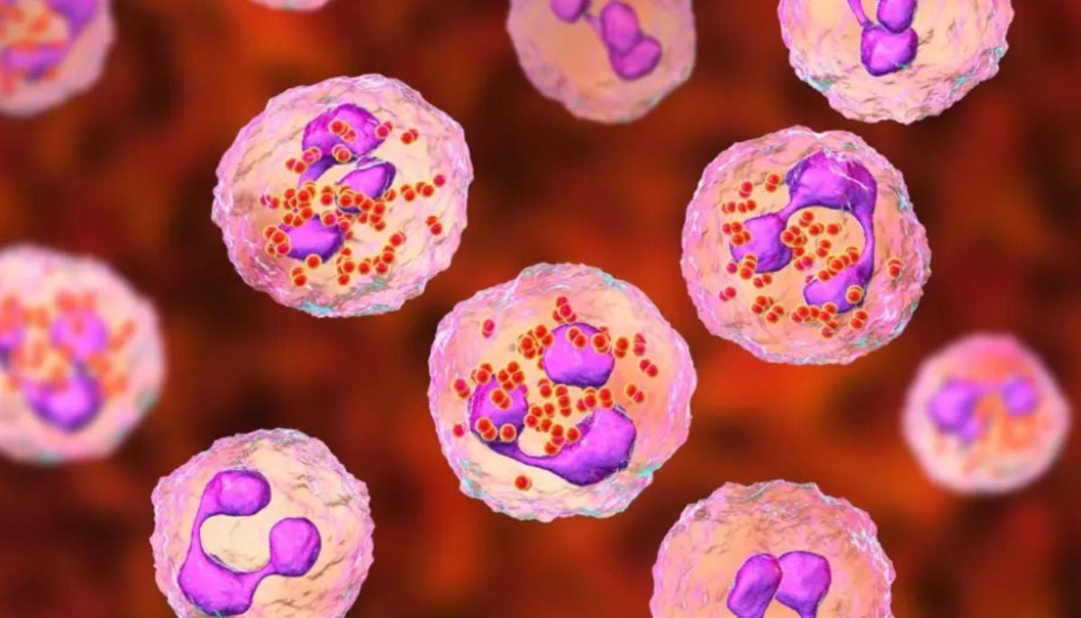 One dead, two critically ill after contracting meningitis; Know how it spreads