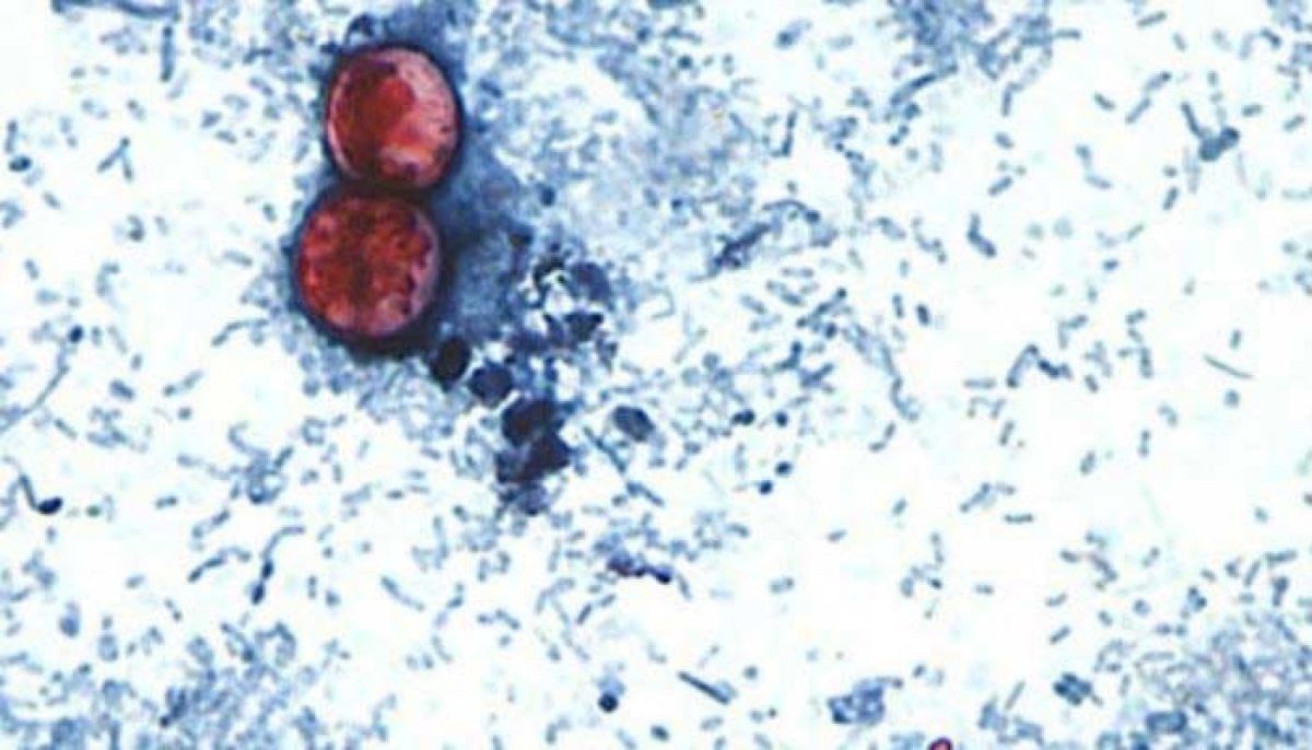 Cyclospora outbreak: is the diarrhoea-causing parasite spreading to Canada?