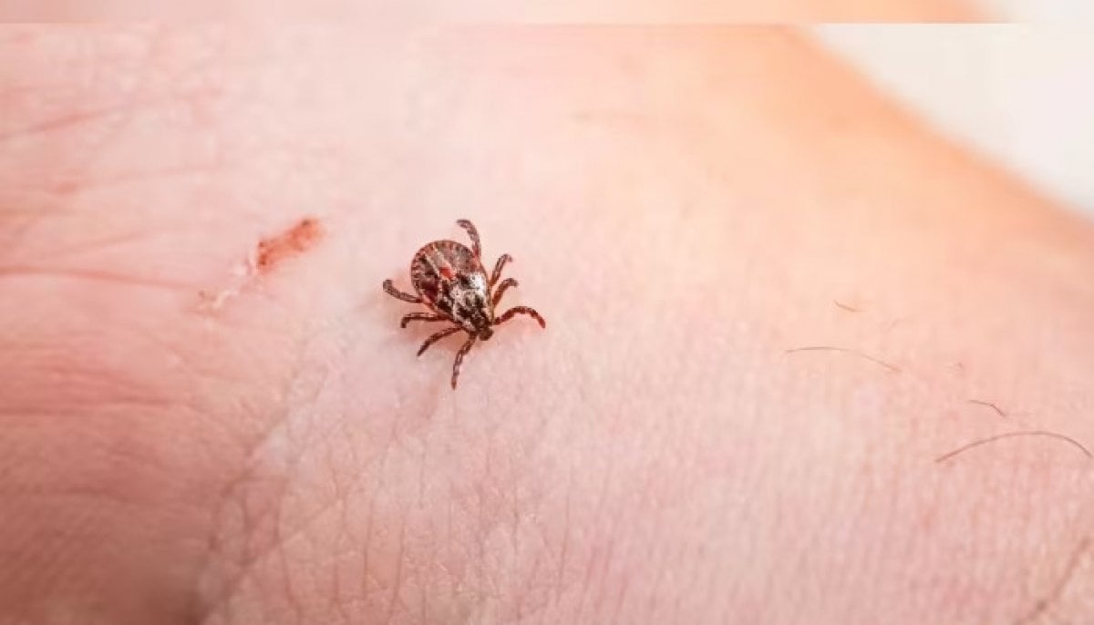 Tick-borne anaplasmosis on the rise in Canada, CMAJ study warns