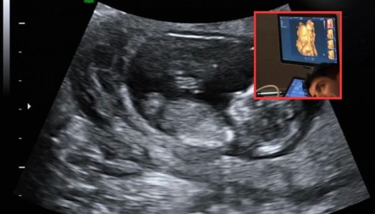 ‘Dad speaks, unborn baby girl smiles:’ Adorable ultrasound video goes viral