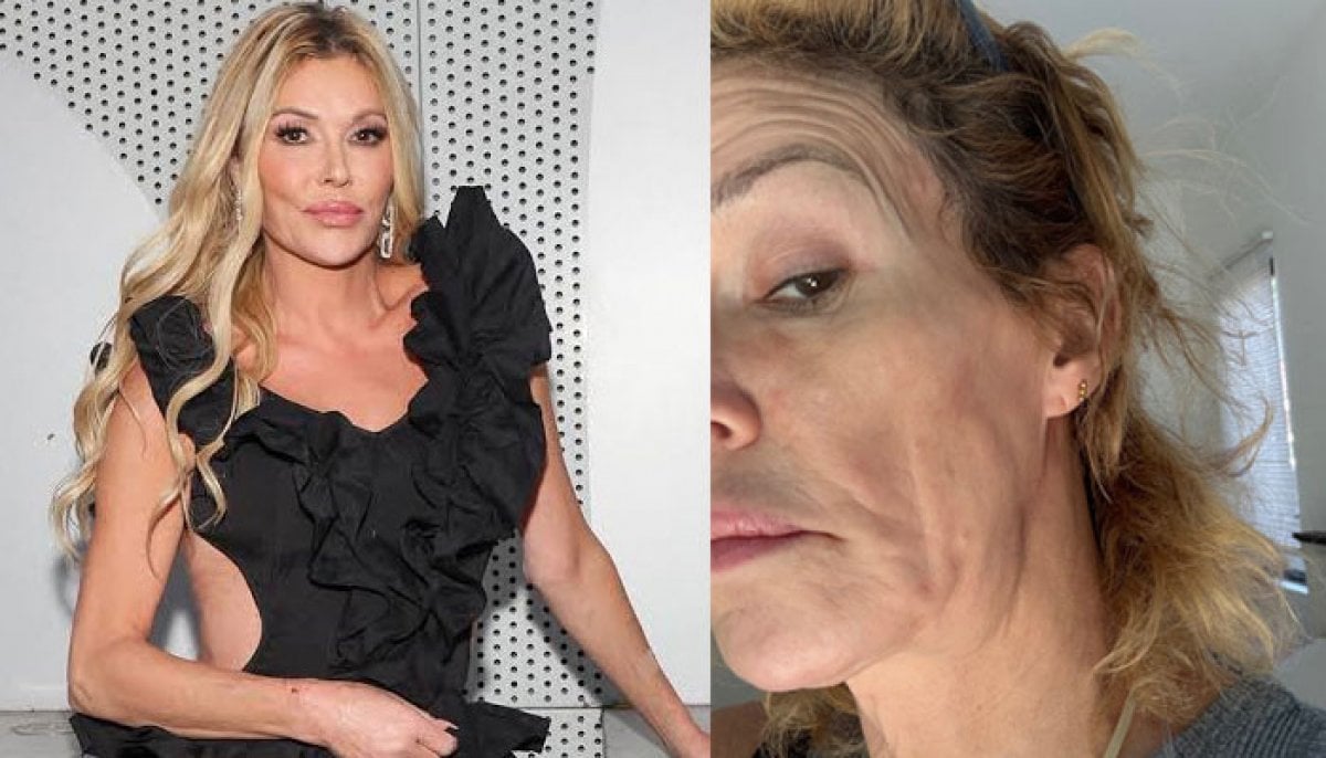 Brandi Glanville 'embarrassed' to accept fundraiser help