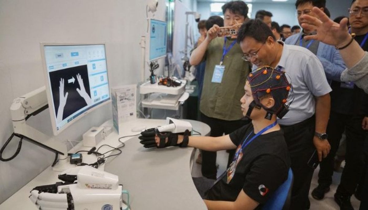 China sets world's first standard for AI brain implants