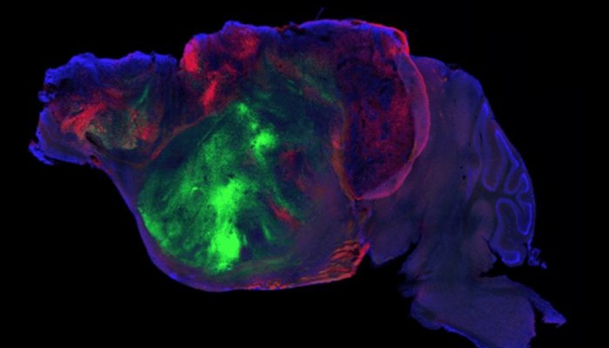 Scientists transplant lab-grown human brain tissue into mice: What they found