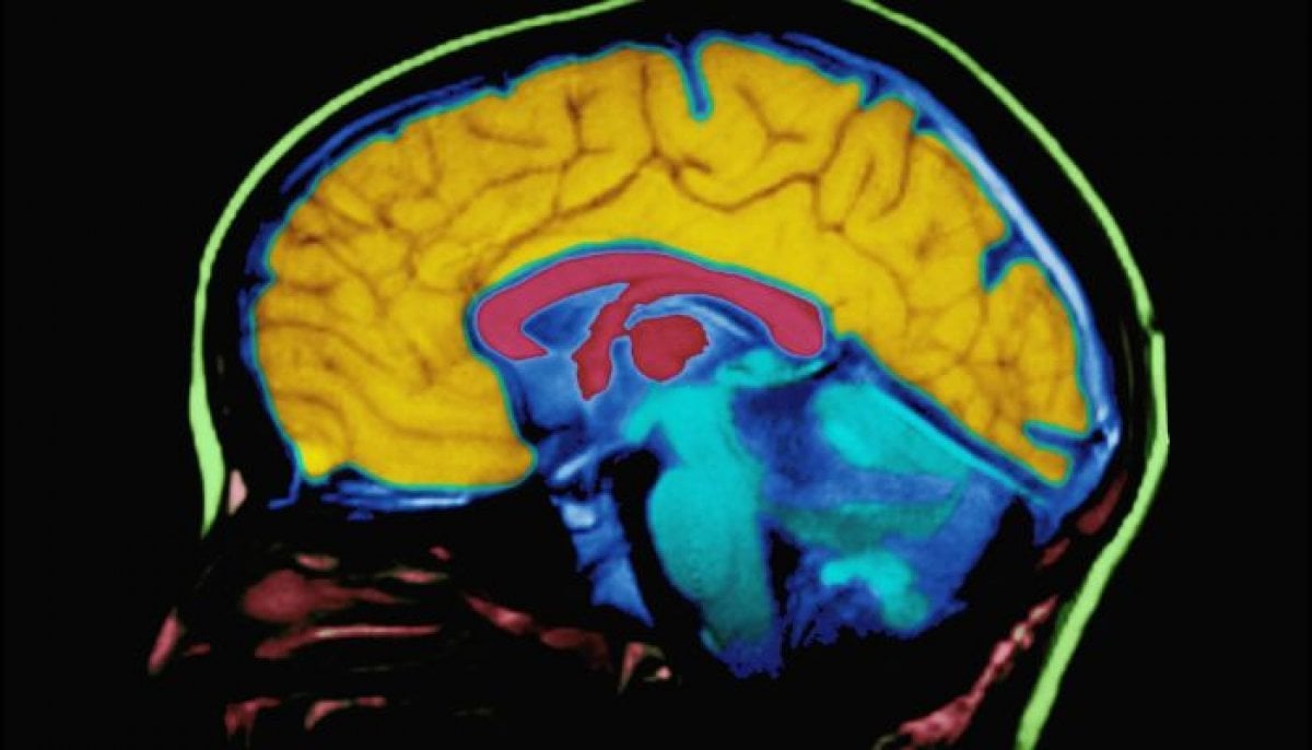 Was the human brain once two separate organs? Scientists find new clues