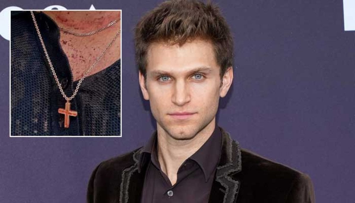 Keegan Allen shares 'painful' update after being violently attacked in armed robbery