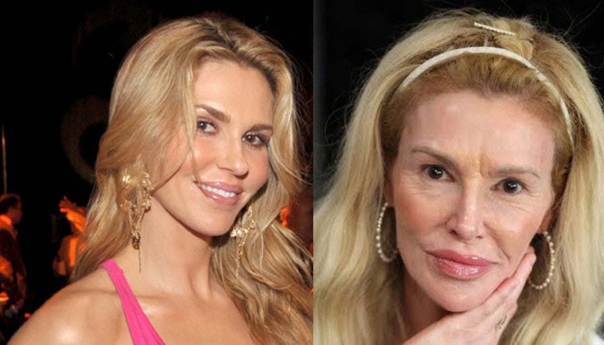 Brandi Glanville 'scared to death' ahead of new corrective surgery on her face