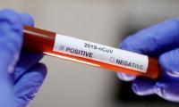 Only two test positive for COVID-19 in Twin Cities in 24 hours