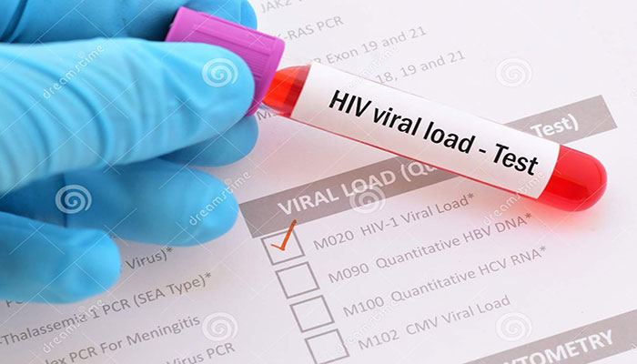 ‘Karachi’s Central district has highest number of people with HIV in Sindh’
