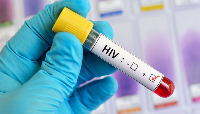 5.28pc of Sindh's blood donors found infected with HIV, hepatitis B and C, malaria, syphilis - Vimarsana News