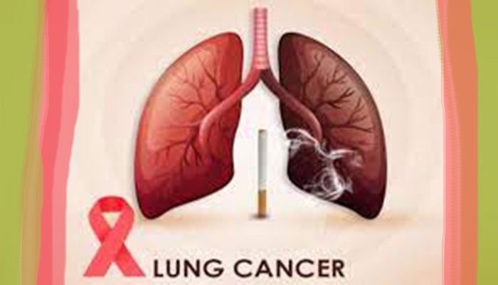90pc of lung cancer cases caused by smoking, seminar told