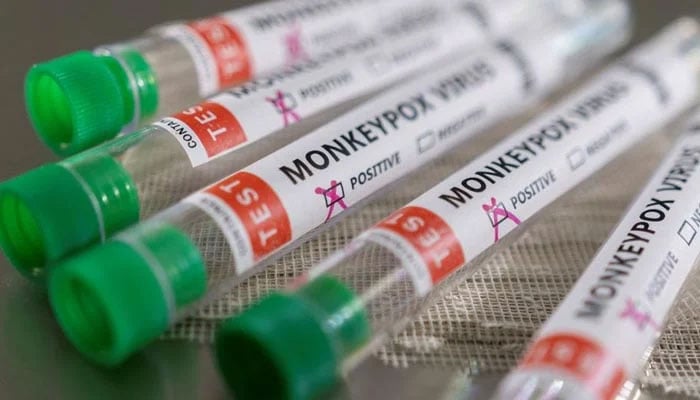 Test tubes labelled Monkeypox virus positive are seen in this illustration taken May 22, 2022. Photo: Agencies