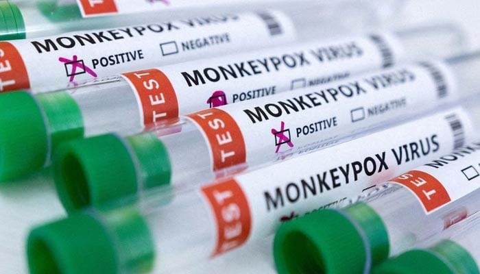 Monkeypox outbreak can be contained, says White House