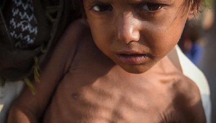 Pakistan is facing a second wave of catastrophe following devasting floods. — AFP