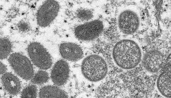 A monkeypox virion, obtained from a clinical sample associated with the 2003 prairie dog outbreak. — AFP/File