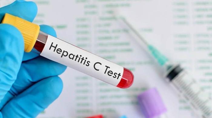 Pakistan has highest hepatitis C burden in world: PKLI BoG chairman - Vimarsana News