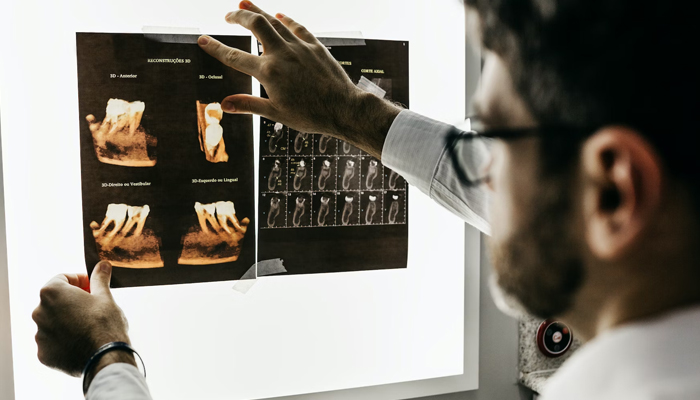 A representational image of a person examining an Xray. — Unsplash/File
