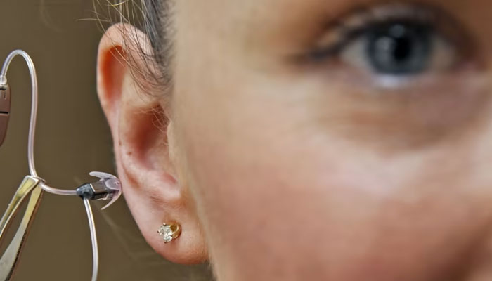 A hearing aid. — AFP/File