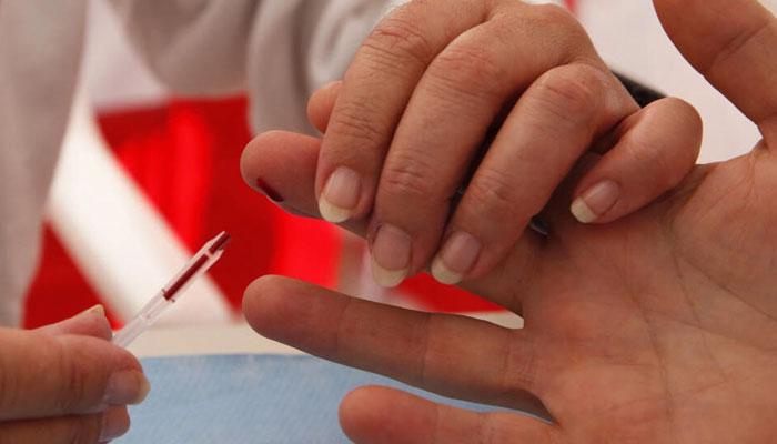 A man undergoes a screening for HIV in Monaco on November 25, 2015. — AFP