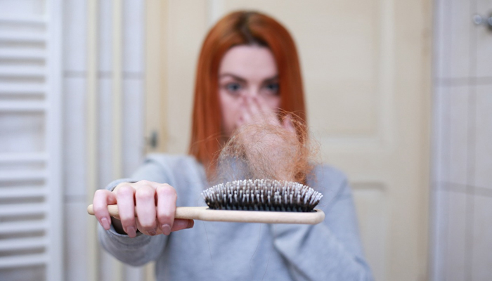 This representational image shows a girl holding a hairbrush full of fallen hair. — Pixabay/File