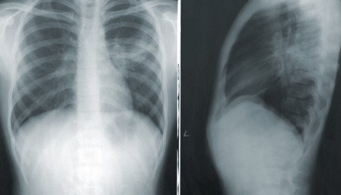 A representational image shows an X-ray — Unsplash