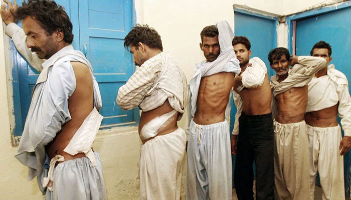 A representational image showing men revealing the scars where their kidneys were removed as part of illegal organ trade in Lahore. — AFP/File