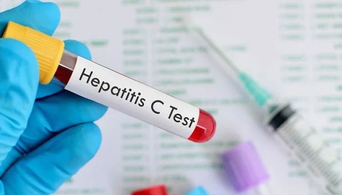 A test tube can be seen in this picture with the name Hepatitis C on it. — Pixabay/File