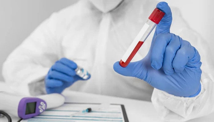 Representational image of blood test. — Welzo website