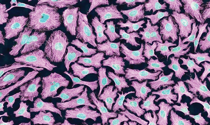 Rare albino Galapagos giant tortoise faces the world