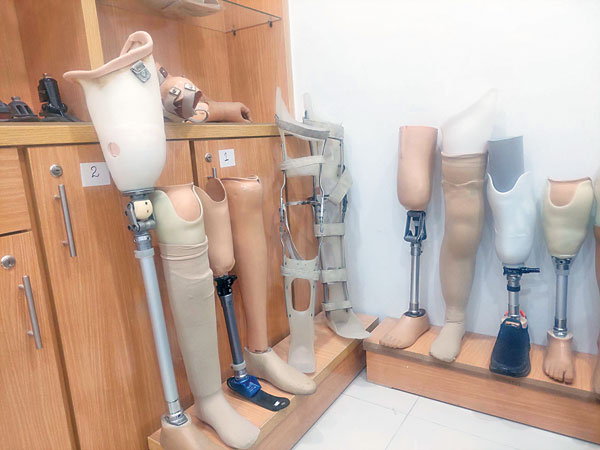 Prosthetics on display