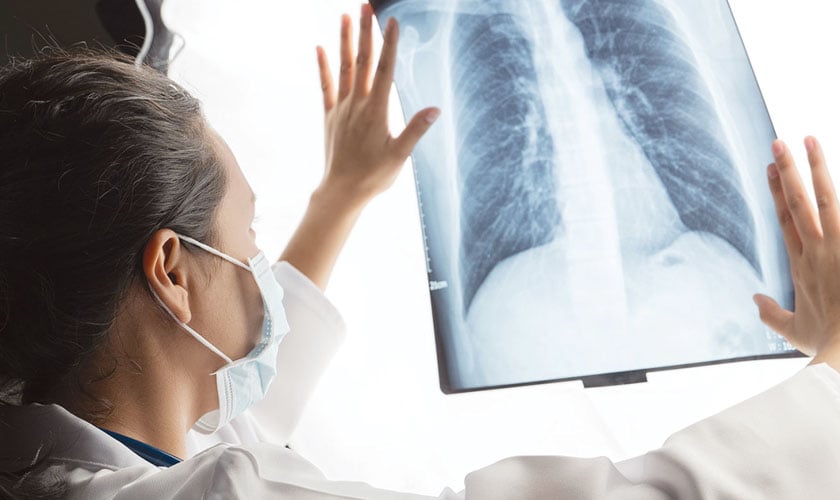 X-rays – a medical marvel