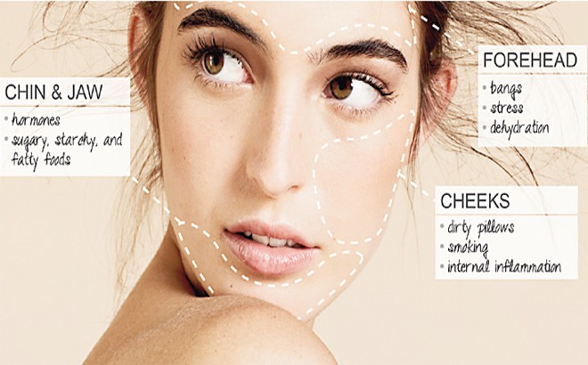 Beauty Station! Face Mapping: Your Acne Guide