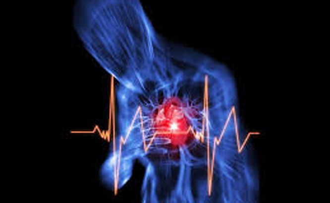 What is angina?  