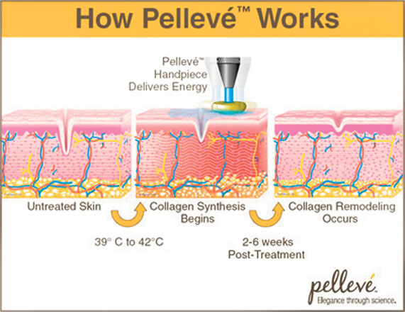 Pelleve-Works