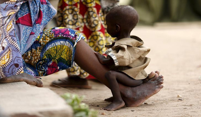 U.N. says 1.4 million children at imminent risk of death in famines