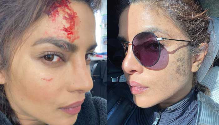 Priyanka Chopra injured on set of Citadel