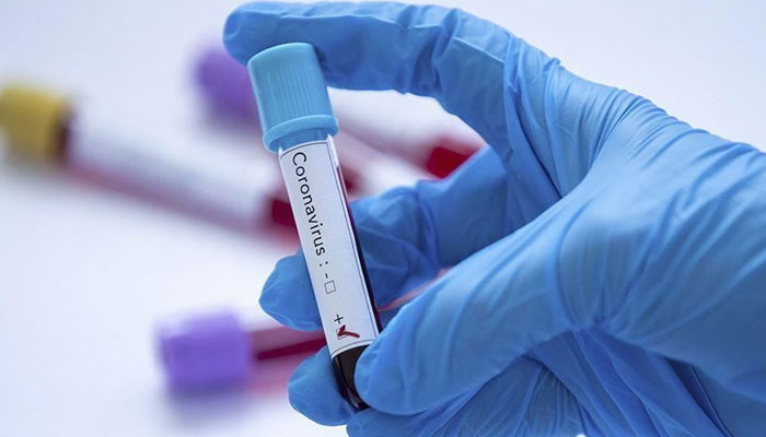 83 more people succumbed to the novel coronavirus during the past 24 hours. Photo: file
