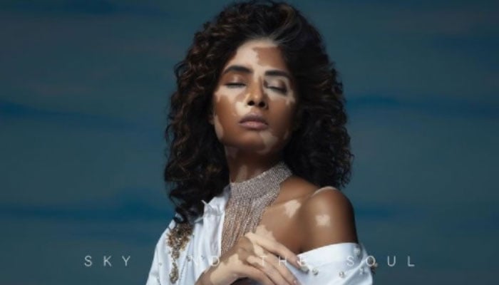 Pakistani photographer under fire for ‘mocking’ vitiligo skin condition via photoshoot