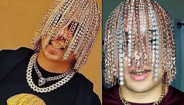Gold hair': Mexican rapper goes viral after getting gold chain hooks  implanted into scalp | Trending News - The Indian Express