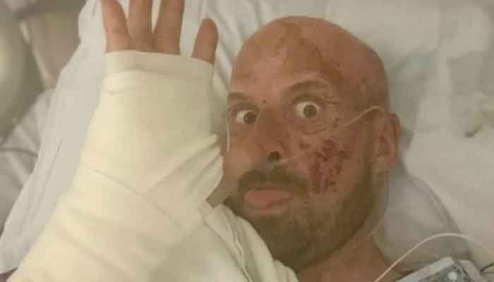Jonathan Goodwin: injured AGT: Extreme contestant sends message from hospital bed