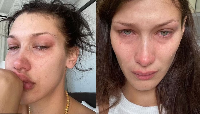 Bella Hadid membuat penggemar menangis saat dia membagikan selfie yang menyayat hati