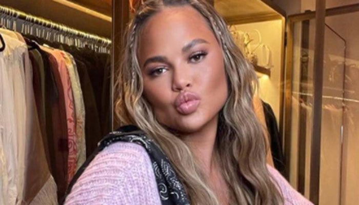 Chrissy Teigen receives flak for eyebrow transplant: The world is going to hell