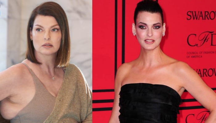 Linda Evangelista is ready to talk about a hellish cosmetic procedure that left her permanently deformed
