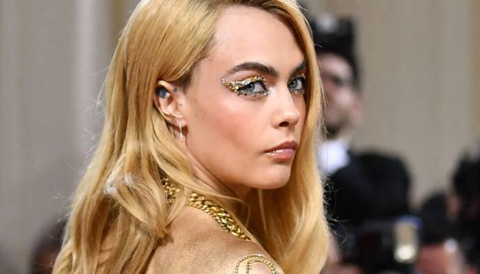 Cara Delevingne ‘flaunting her psoriasis’ at Met Gala melt down netizens’ hearts